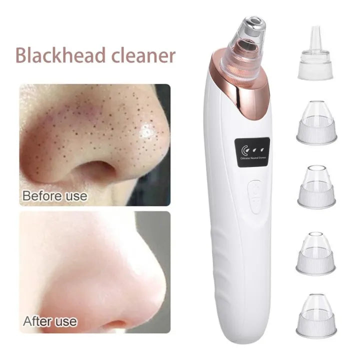 Facial suction tool for acne removal and oil control treatment